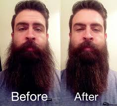 Beard before and after