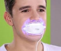 Teeth whitening